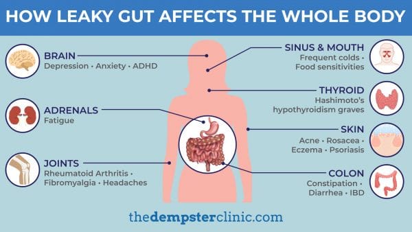 Leaky Gut effect on whole body
