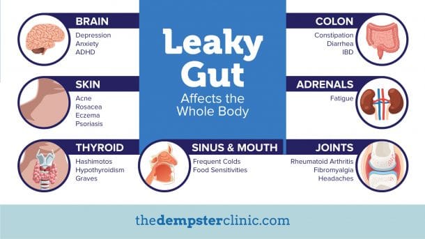 Leaky Gut Syndrome – The Silent Killer - The Dempster Clinic