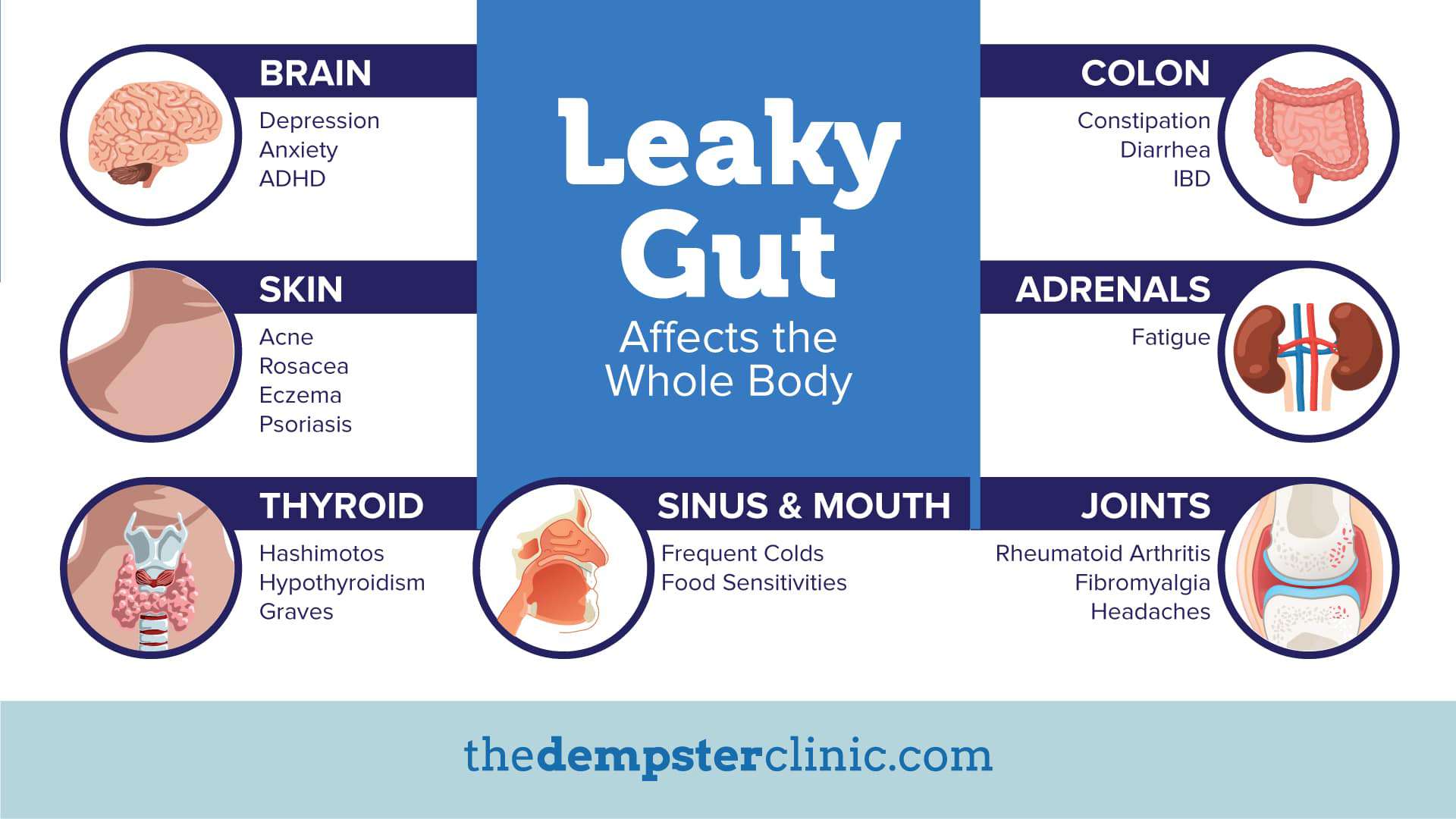 Leaky Gut Syndrome The Silent Killer The Dempster Clinic Toronto