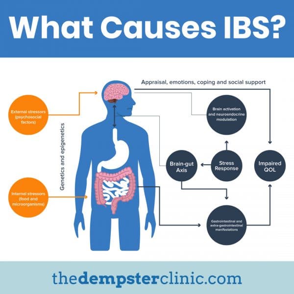 What causes ibs?