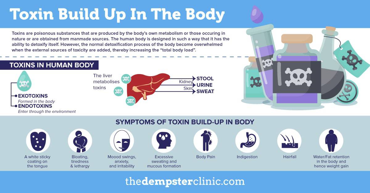 toxin buildup in body The Dempster Clinic