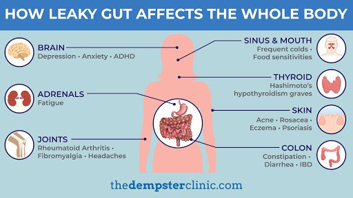 how leaky gut affects the whole body