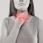 What You Need To Know About Hashimoto’s And Other Thyroid Diseases