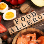 Know The Difference Between Food Allergies, Sensitivities, and Intolerances