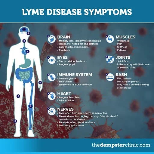 Is Chronic Lyme Disease Real?