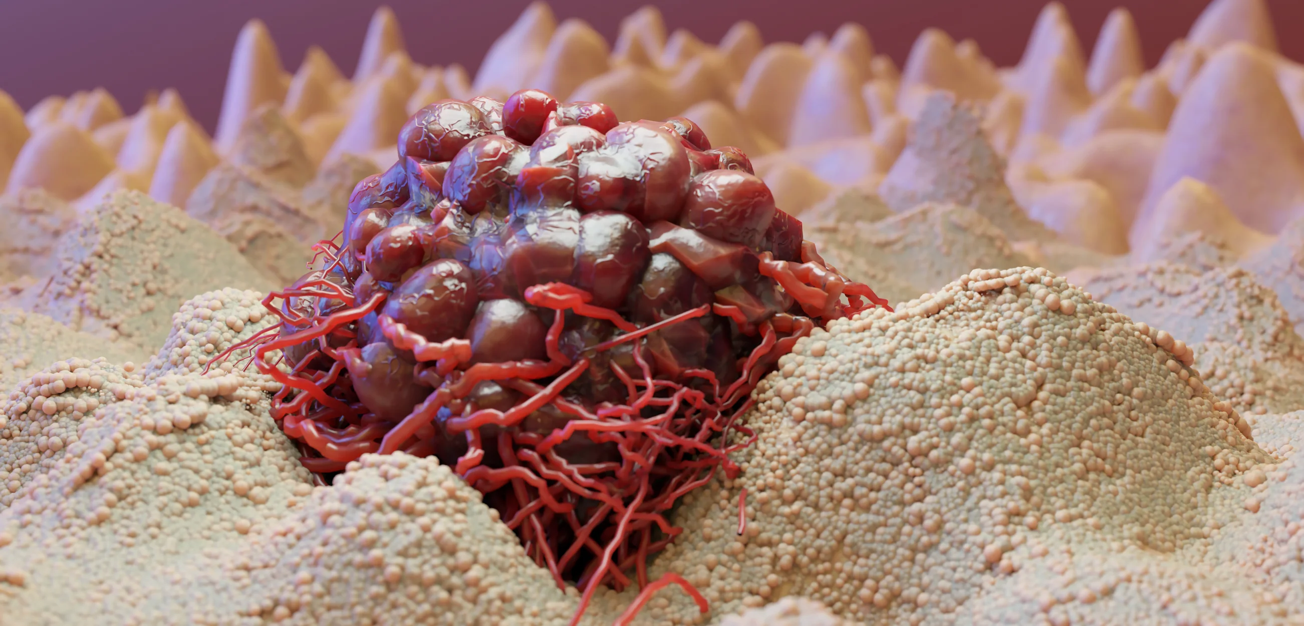 Read more about the article Understanding the Gut Health-Cancer Link